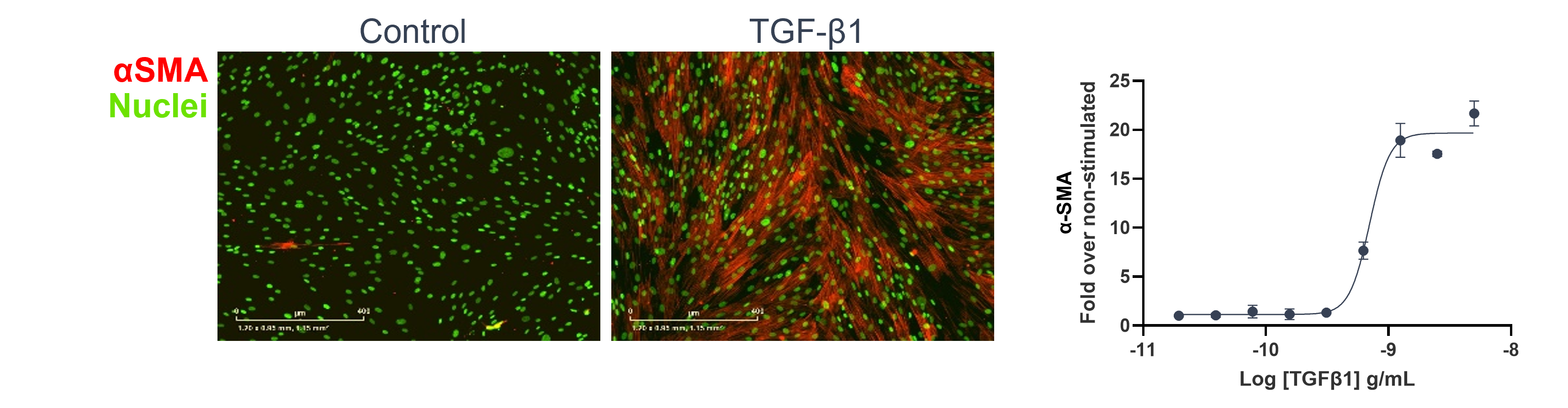 FMT (Primary human fibroblasts) assay readout