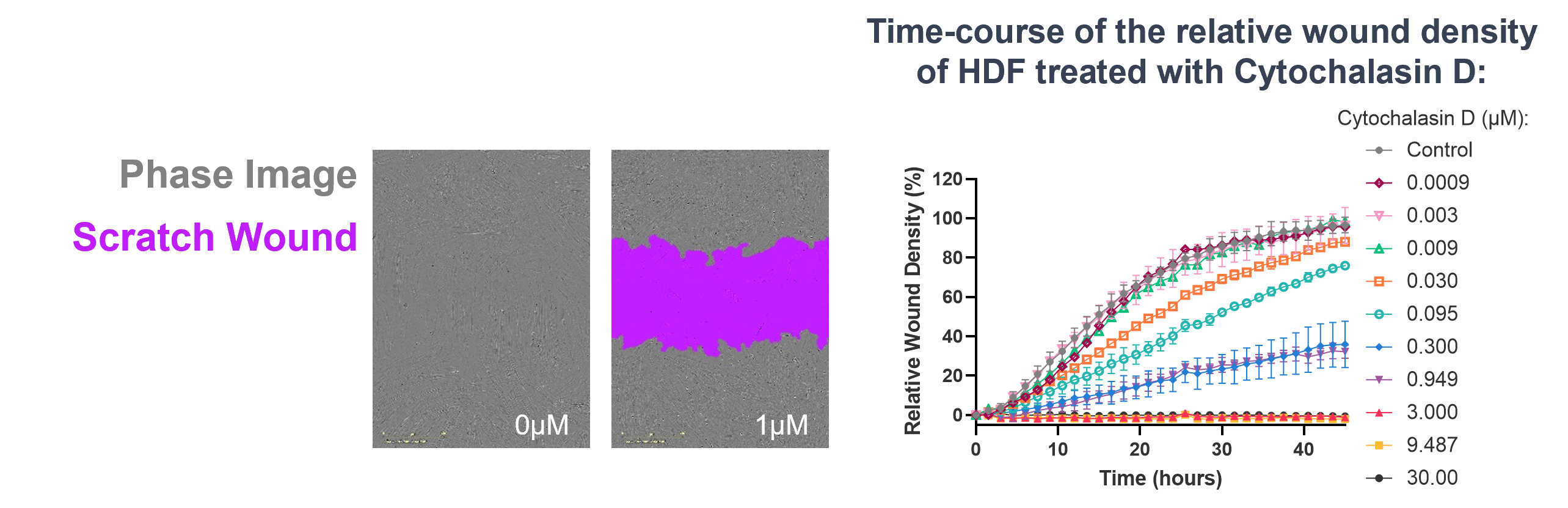 FMT (Primary human fibroblasts) assay readout