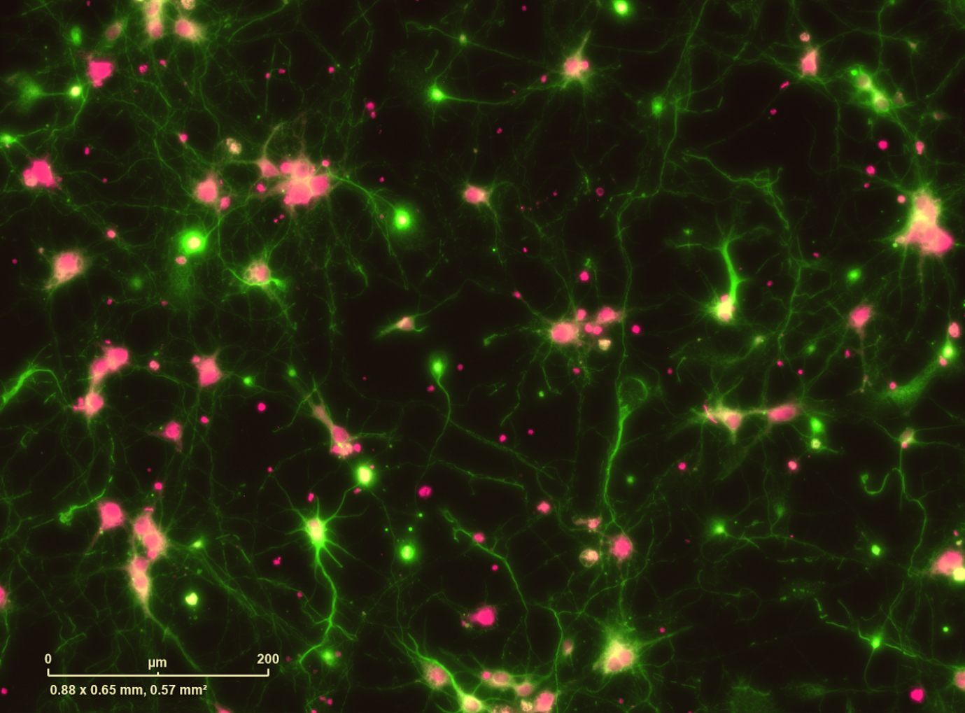 Beta 3 tubulin staining of neuronal cytoskeleton and NeuN staining of nuclei in rat cortical neurons 