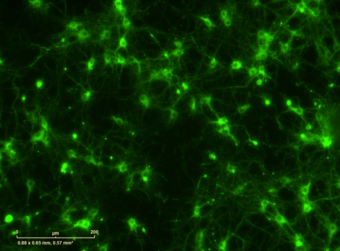 Beta 3 tubulin staining of neuronal cytoskeleton in rat cortical neurons