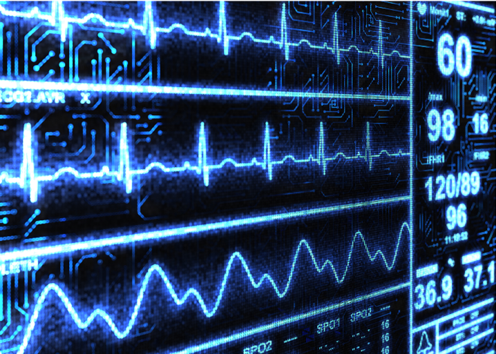 electrocardiogram output