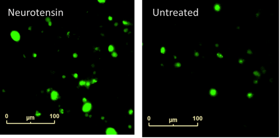 Neurotensin-induced phagocytosis a