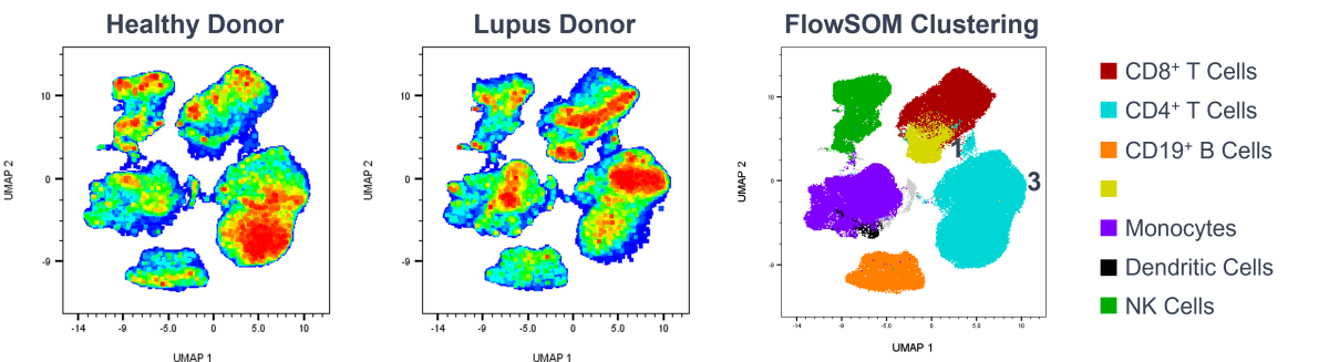 Differences in cell surface marker expression between healthy and lupus PBMC donors. 