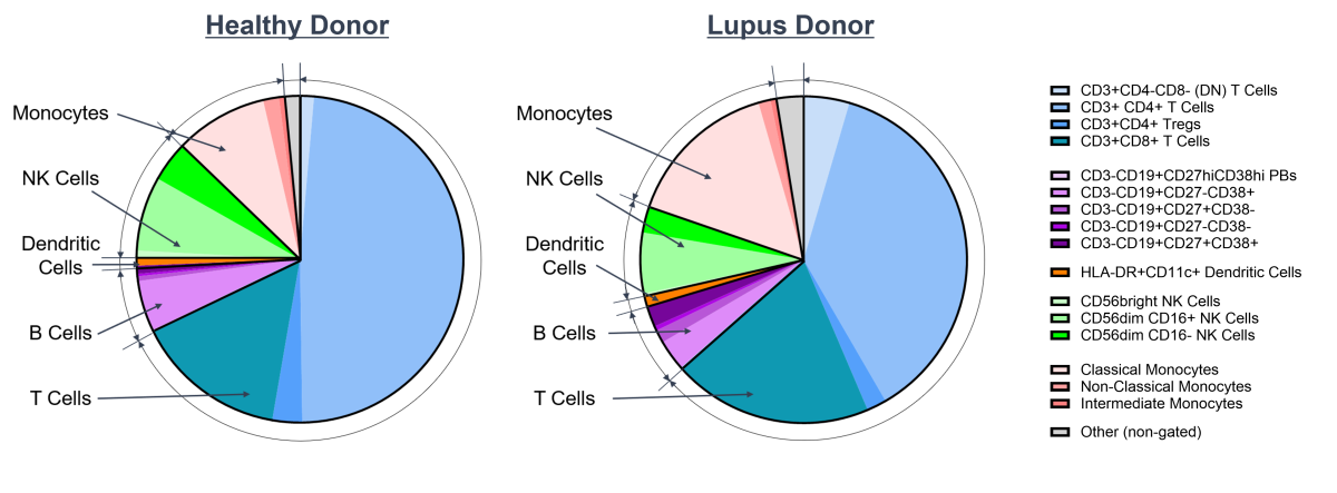 Pie chart showing altered cell subset distribution between healthy and lupus donors. 